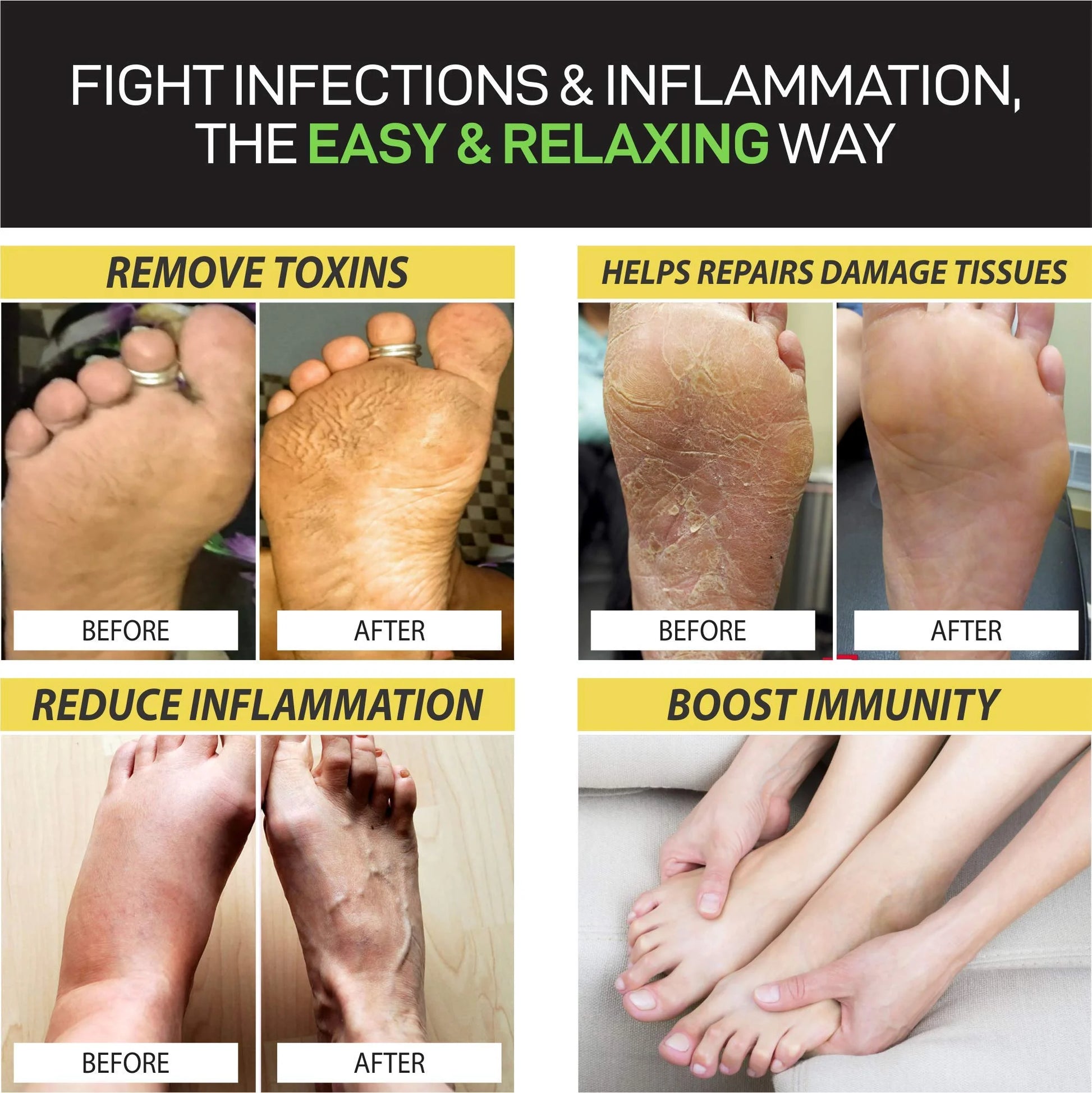Citrus Detox Foot Soak with Epsom Salt - Removes Toxins, Foot Callus, Boost Immune, Helps Treat Athletes Foot, Inflammation, Tired, Aching Feet and Toenail Fungus Lbs1